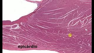 Histologia do coração  Valvas Purkinje esqueleto fibroso [upl. by Mil701]