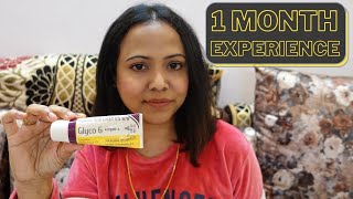 My 1 Month Experience with Glyco 6 Cream  Honest Review in Hindi Personal Experience [upl. by Aynatahs]