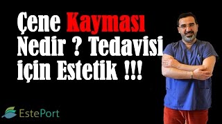 Çene Kayması Nedir  Tedavisi İçin Estetik [upl. by Armilda]