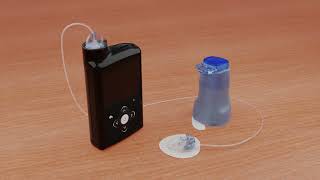 Inserting the Medtronic Extended™ infusion set [upl. by Pears]