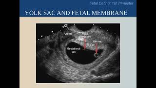 Ultrasound Training Course 09 part 1 [upl. by Angeline66]