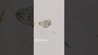 dying rotifer under the microscope 200x  800x magnification sciencemicroscope 7 [upl. by Angil]