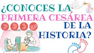 ¿Cuál fue la primera cesárea de la historia 🤰 [upl. by Neelram]