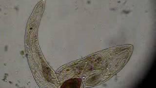 Gyratrix hermaphroditus Fam Polycystididae F Platyhelminthes 1 [upl. by Rhody]