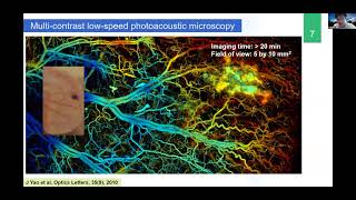 Junjie Yao  UltraHighSpeed Photoacoustic Imaging of Brain Functions [upl. by Krum]