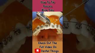 How To Tie Braces  Wire Tie Ligatures [upl. by Anaeco]