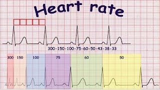 ECG basics Methods of heart rate calculation [upl. by Yeslek903]