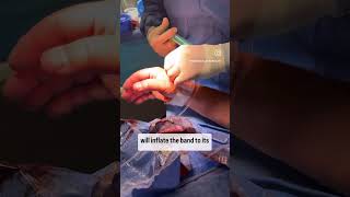 Snuff Box Closure by the Best Our team shows you TR band closure for Snuff Box Radial Access [upl. by Yborian]