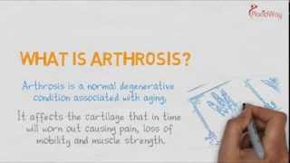 Find the Difference Best Arthritis Treatment and Best Arthrosis Treatment  PlacidWay [upl. by Prospero]