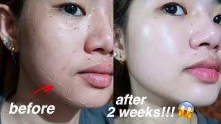 KOREAN SKIN IS REAL😱 I TRIED REJUVINATING SET FOR 2 WEEKS AND THIS IS WHAT HAPPENED [upl. by Tuttle]