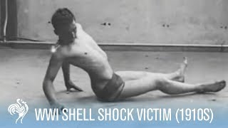 World War 1 Shell Shock Victim Recovery 1910s  War Archives [upl. by Stempson]