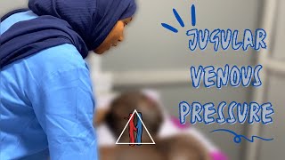 How To Examine and Measure The JVP Jugular Venous Pressure [upl. by Smiga]