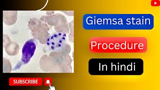 Giemsa stain procedure in hindi l giemsa stain kese karte hai l Giemsa stain for bone merrow l [upl. by Etnoled750]