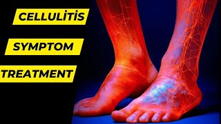 Cellulitis Causes Symptoms Treatment and Prevention  Health Go [upl. by Aubrette]