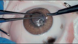 Cornea Suture 101 [upl. by Aianat]