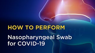 Nasopharyngeal Swab for COVID19 [upl. by Anahoj]