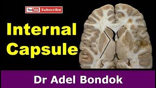 Internal Capsule Dr Adel Bondok [upl. by Wester322]