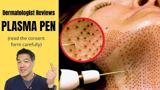 PLASMA MOLE REMOVER PEN REVIEW amp DEMO I Does it really remove freckles skin tags and moles [upl. by Estrin162]