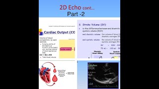 Basics of 2D Echo Part 2in Hindi  What is Ejection Fraction  What is EDV ESV SV and CO [upl. by Teahan]