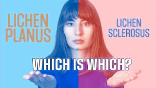 Lichen Sclerosus and lichen planus whats the difference [upl. by Noiztneb]