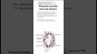 Placenta accreta and risk factors [upl. by Nivanod884]