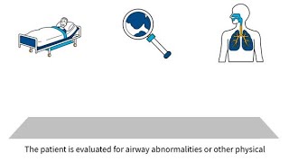 McGRATH™ MAC Video Laryngoscope Byte 2 Predicting difficult airways [upl. by Yeo]