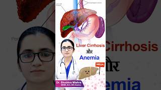 Liver cirrhosis or anemia shorts [upl. by Audris]