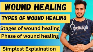 Wound Healing pathologyTypes of wound healingStages of Wound HealingPhase of wound healing [upl. by Annoya]