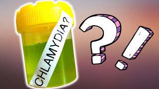 You could have CHLAMYDIA TRACHOMATIS [upl. by Rainger971]