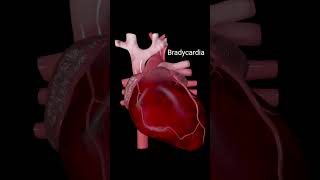 Heart anatomy heartattack heartbeat bradycardia 3danimation [upl. by Yknarf]