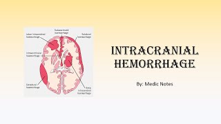 Intracranial hemorrhage  intracerebral vs extracerebral extradural subdural subarachnoid [upl. by Gulick]