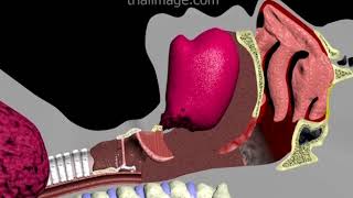 Endotracheal Intubation Animation by Cal Shipley MD [upl. by Sankey]