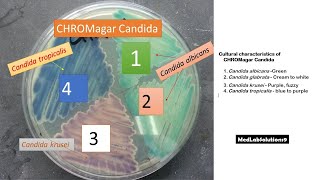 Candida species identification using Candida Chromagar│ C albicans│ C topicalis│ glabarata│krusei [upl. by Meece908]