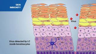 Immune response in the skin [upl. by Brookner]