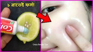 মাত্র ১ রাতেই আপনাকে এতোটা ফর্সা করে দেবে এই টিপসটি।যে পুরো দুনিয়া অবাক।How To Get Fair Look [upl. by Kilroy]