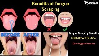 Benefits of Tongue Scraping [upl. by Haldan]