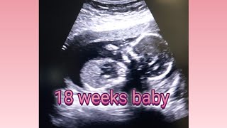 18 Weeks Baby Ultrasound  Posterior Placenta  Pregnancy Usg  How To Tell Gender On Ultrasound [upl. by Wileen]