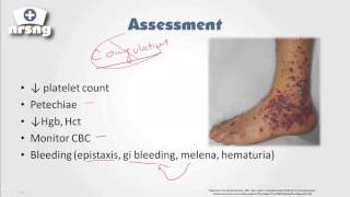 Thrombocytopenia NCLEX® Review  NRSNGacademycom [upl. by Nref]