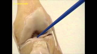 Anatomy of the knee joint [upl. by Robinson]