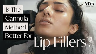 The Cannula Method For Lip Fillers 💋 2021 Natural Lip Filler [upl. by Eciral664]