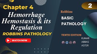 Hemorrhage  Hemostasis and its Regulation  Lecture 2 Chapter 4 Robbins Pathology [upl. by Ardnuas391]