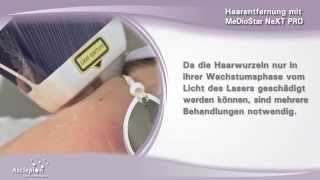 Haarentfernung mit dem Diodenlaser MeDioStar NeXT PRO von Asclepion [upl. by Ecille29]