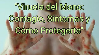 quotViruela del Mono Contagio Síntomas y Cómo Protegertequot [upl. by Yenreit]