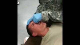 My first Nasal Pharangeal Airway [upl. by Nrevel443]