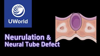 Neurulation amp Neural Tube Defects  Anencephaly Spina Bifida Occulta  USMLE Uworld Step 1 MBBS [upl. by Emeric]