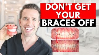 Braces Off How to know if youre DONE WITH BRACES [upl. by Aydiv]