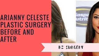 Arianny Celeste Plastic Surgery Before and After [upl. by Cresida]