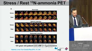 Cardiac  Quantification of myocardial perfusion Which test is the best PET MRI MDCT 1 [upl. by Lezirg]