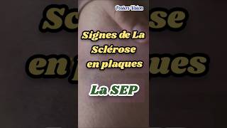 Signes Symptômes Sclérose en plaques SEP scleroseenplaques TroublesDuSommeil neurodegenerative [upl. by Jerrol664]