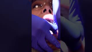 Preparation is key 🦷 Watch as Dr Van Horn sets up for precision and accuracy with guide placement [upl. by Whitver582]